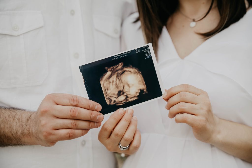 Baby ultrasound photo frame present